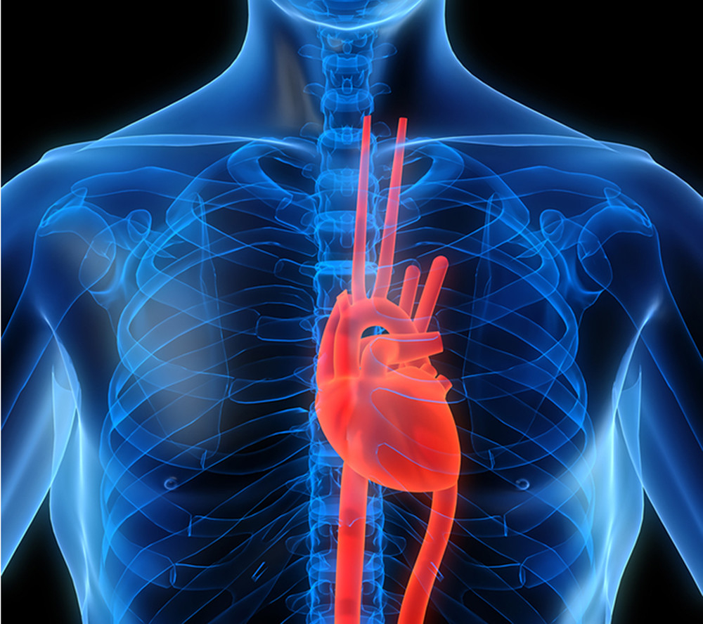 CARDIOVASCULAR DISEASE MEDICAL MARIJUANA