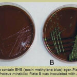 Eosin Methylene Blue Agar EMB Medical Laboratories