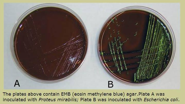 Eosin Methylene Blue Agar EMB Medical Laboratories