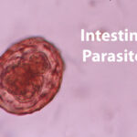 Intestinal Parasites Facts And Prevention Brookfield Animal Hospital