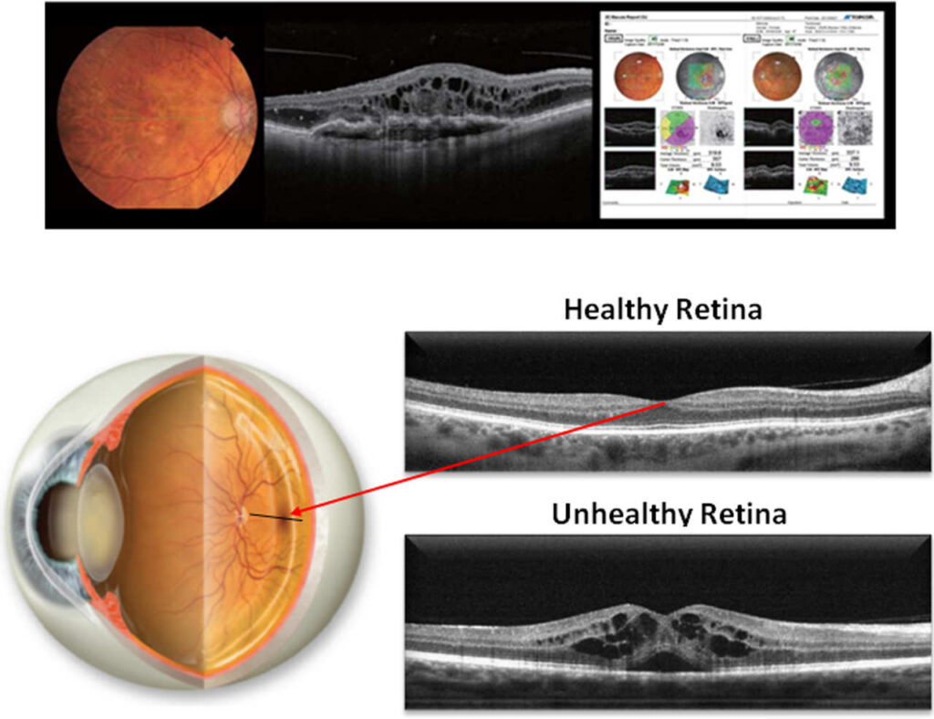 Patient Information Forms Acuity Vision Eyewear Center