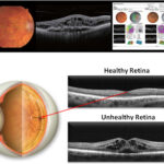 Patient Information Forms Acuity Vision Eyewear Center