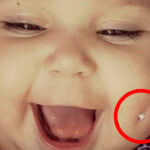 Picture Of Baby With Pierced Dimple Sparks Outrage